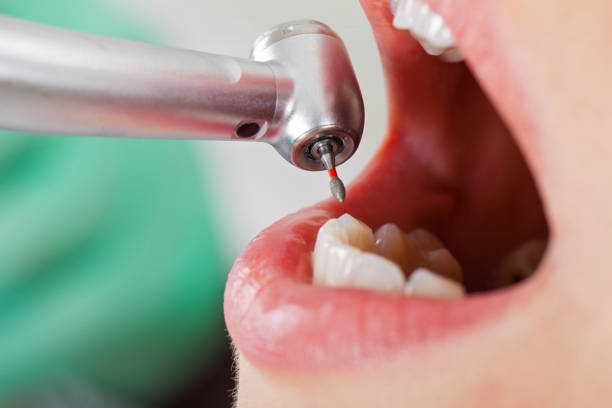 Best Emergency Root Canal Treatment in Fivepointville, PA
